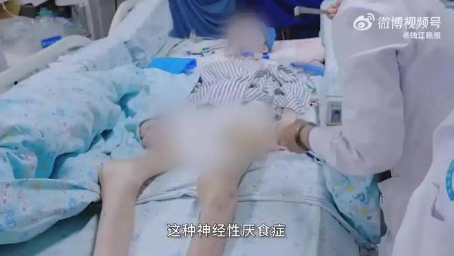 美国40%韩国344%中国令人意外开元棋牌中美韩人口肥胖率差距断崖：(图14)